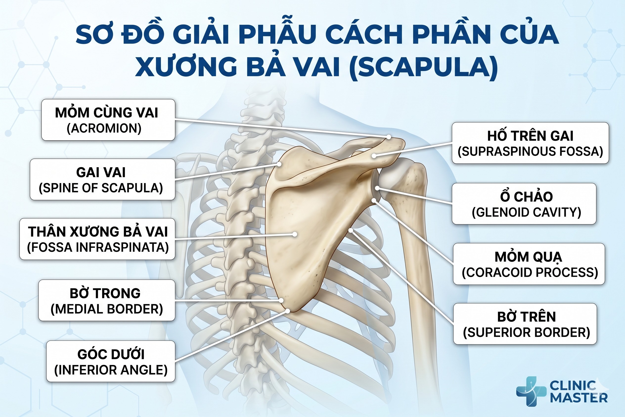 Phân loại gãy xương bả vai
