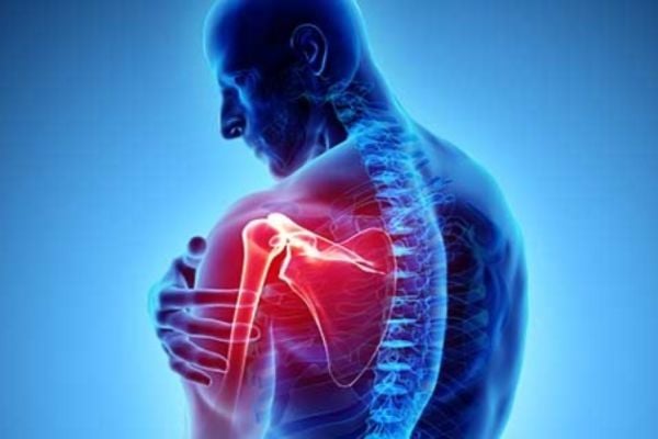 Chấn thương vai khi chơi bóng chuyền