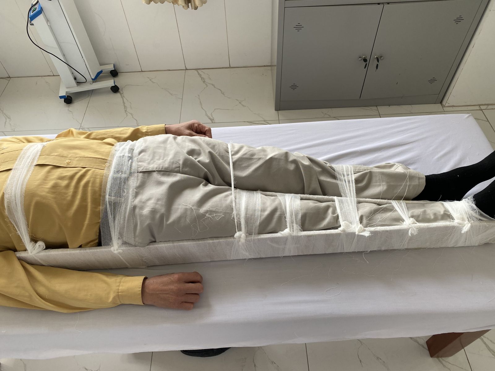co-dịnh-gay-xuong-cang-chan