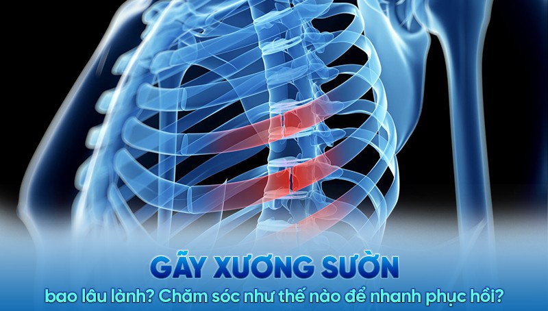 Điều trị gãy xương sườn