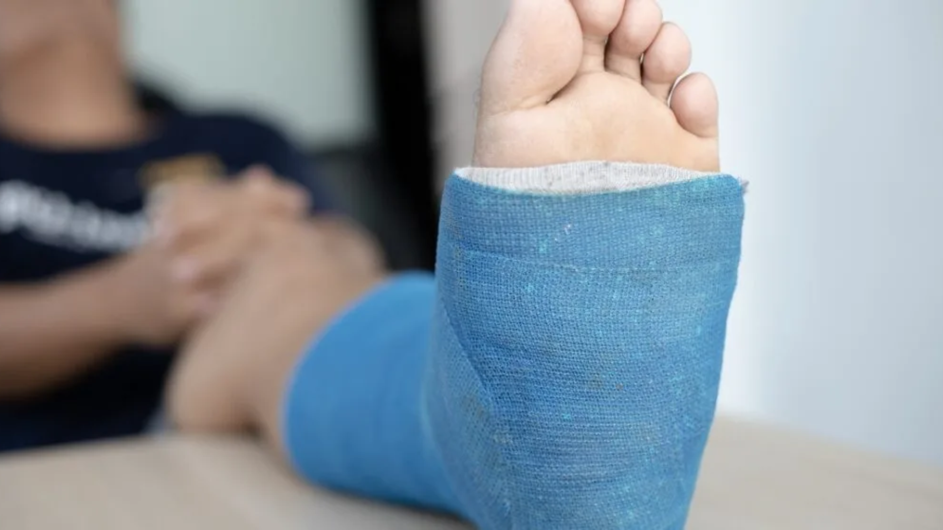 gãy xương bàn chân số 5