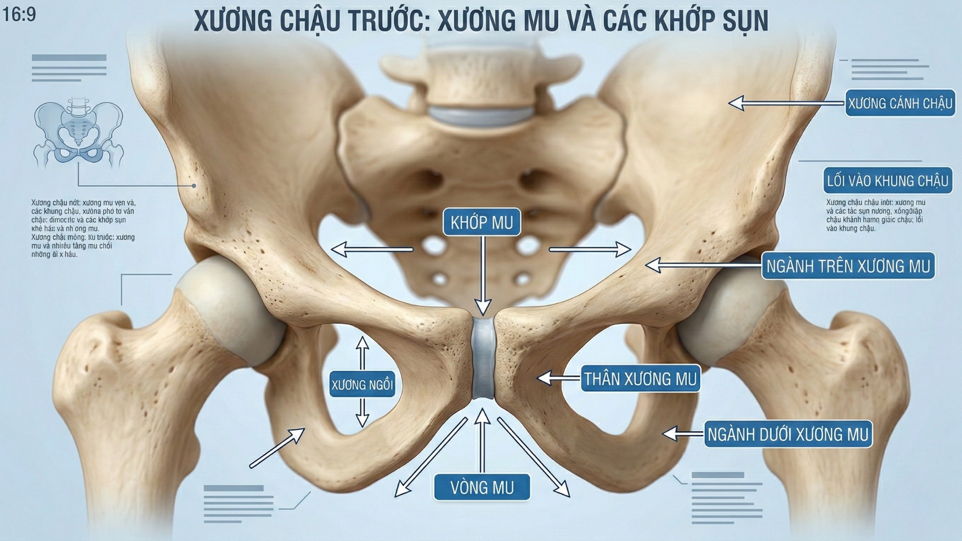 gay_xuong_mu