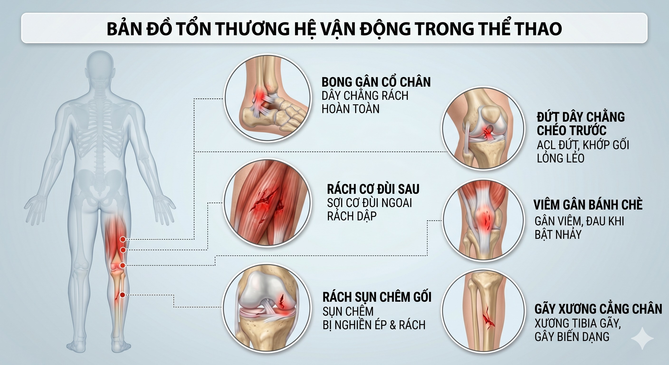 nhung-chan-thuong-trong-the-thao