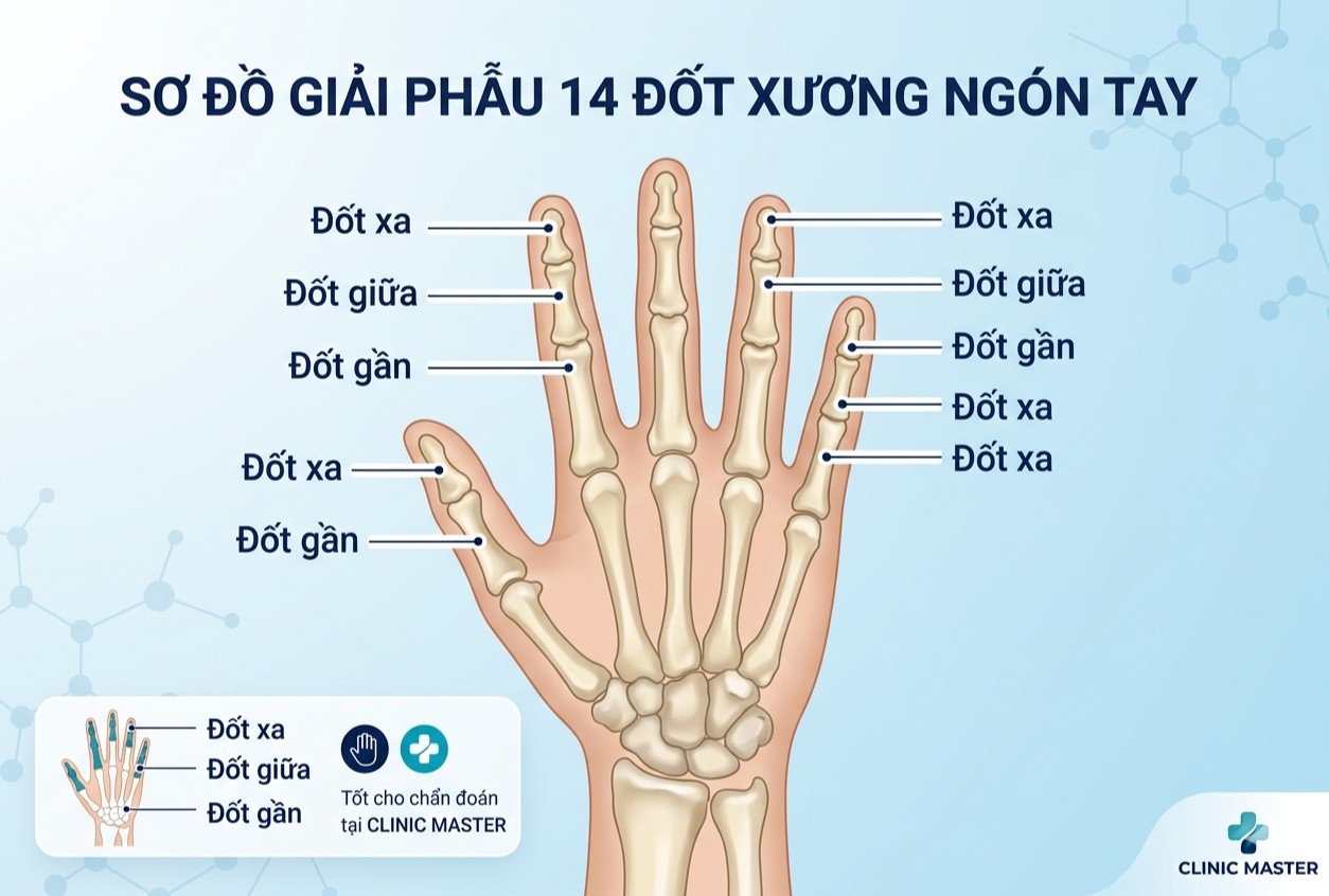 Phân loại gãy xương ngón tay
