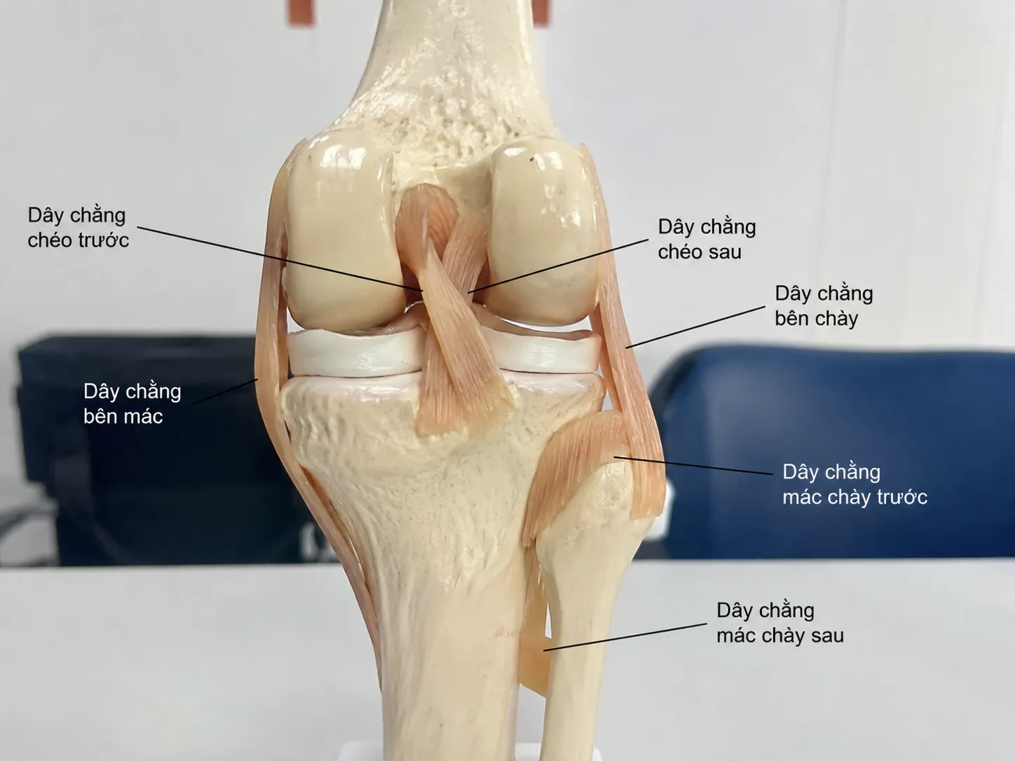 10 Triệu Chứng  Trật Khớp Cần Nhận Biết Ngay